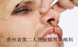 流鼻血怎么处理