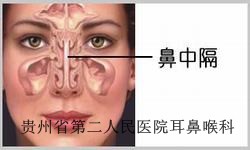 鼻中隔偏曲典型症状有哪些