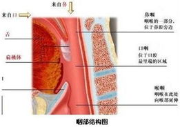 慢性咽喉炎是怎么患上的