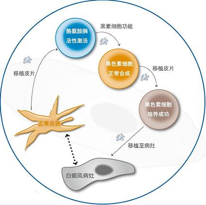 白癜风治疗方法 白癜风治疗方法