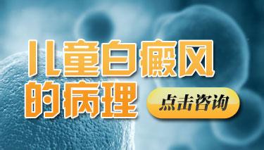 儿童白癜风常见的祛白方式是什么