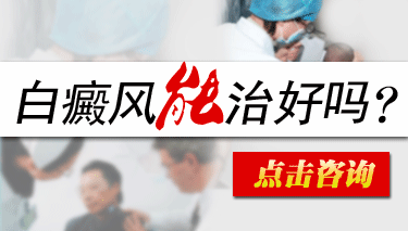 白癜风能治好吗