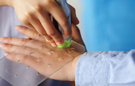 武汉治疗白癜风大概花多少钱