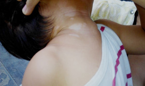 武汉白癜风怎么治疗好得快 武汉白癜风怎么治疗好得快