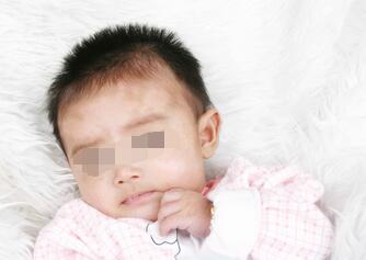 武汉白癜风预防常识有哪些 武汉白癜风预防办法有哪些呢