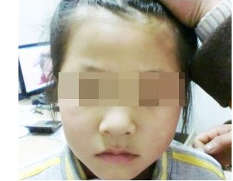 武汉宝宝皮肤有变白要怎么办 武汉宝宝皮肤有变白要怎么办