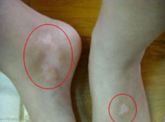 �人����ȥ�ļ�ҽԺ���ã���ô������Ч���ư������ּ���