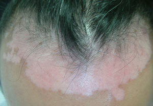 �人��������ô�ߣ�����ĨʲôҩЧ����