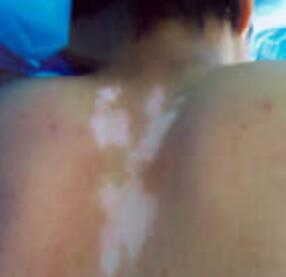 �人��������ҽԺ�ļҽϺã�������ҩ��ԭ������Щ