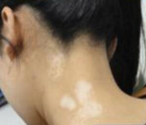 �人�շ������ԭ������Щ��