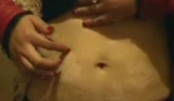 武汉有白癜风治疗的医院吗?哪里治疗白癜风效果好 武汉白癜风早期怎么治疗?治疗白癜风要注意哪些事项?