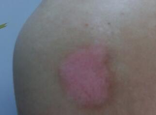 人ΰװĸҽԺã֢״Щ