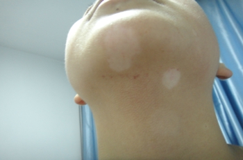 人ļҽԺΰϺãŮ԰֢״Ĳͬʲô