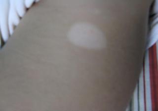 人ΰװ߽ϺҽԺ粡Щ