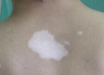 人ͯҽԺư人ļƺ󸴷ԭЩ