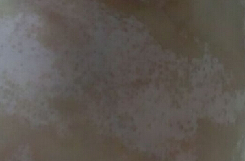 人ĸҽԺưϺã人Ƥ˿Ϊʲôأ