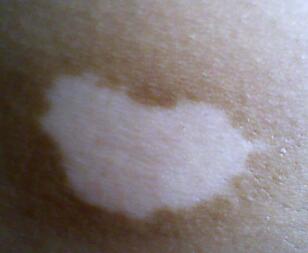 人ΰϺҽԺ人ƺ󱳿ҩ